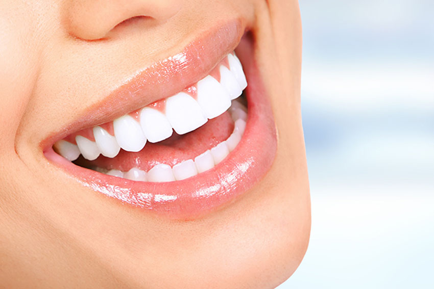 Teeth Whitening-Established Client