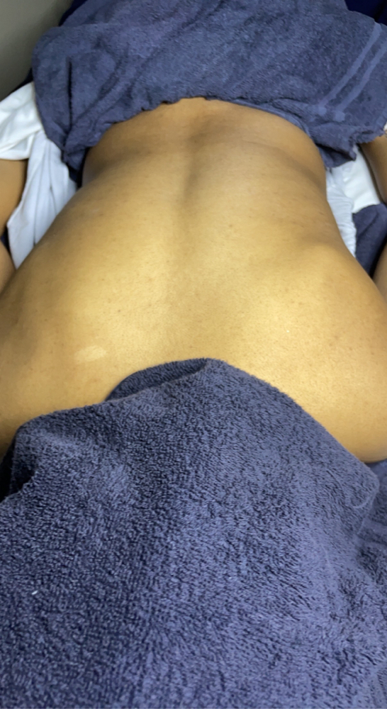 Back Facial