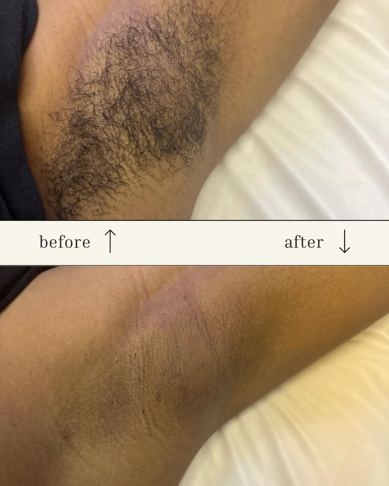 Underarm Wax