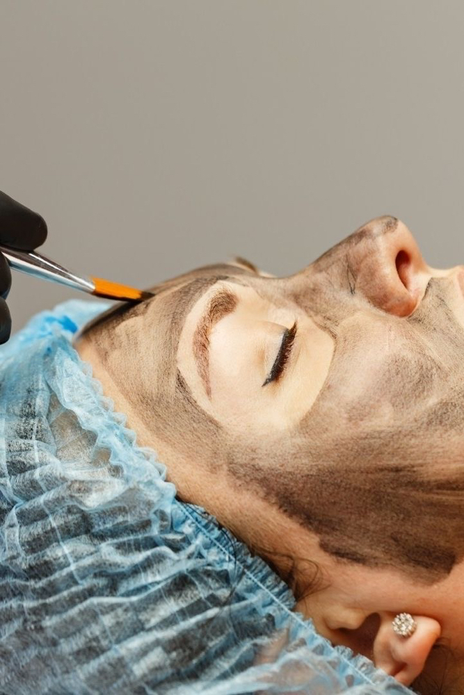 (F) Láser PicoSecond + Limp. Facial at LeBeau Esthétique in San Juan, PR