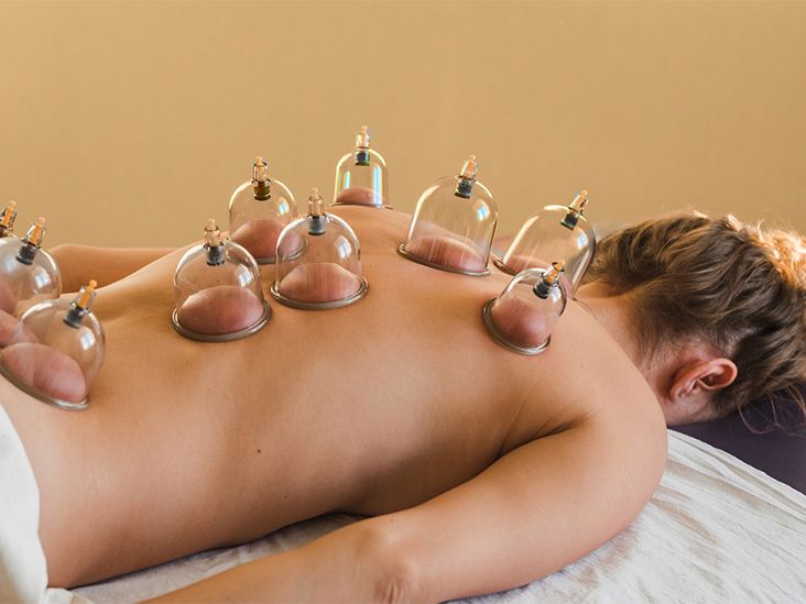 Cupping- Add On