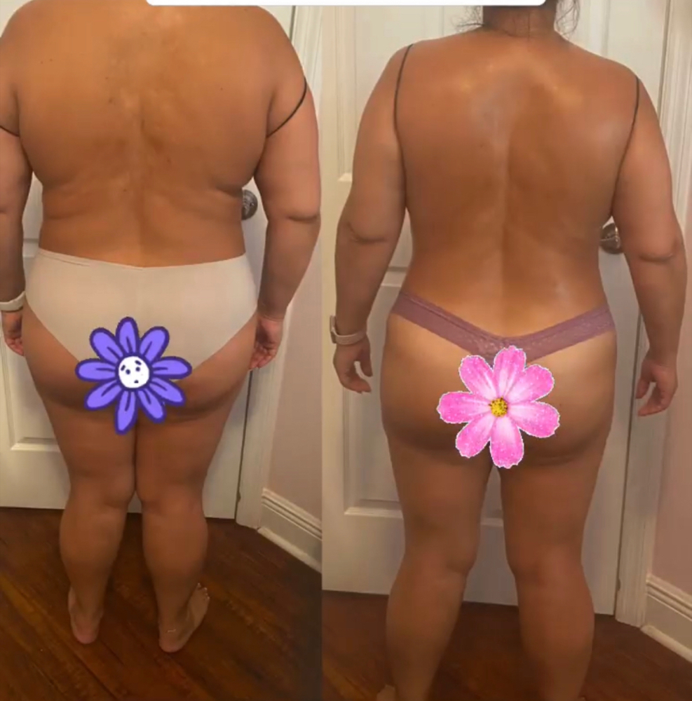 10 Full Body Maderotherapy Treatmen