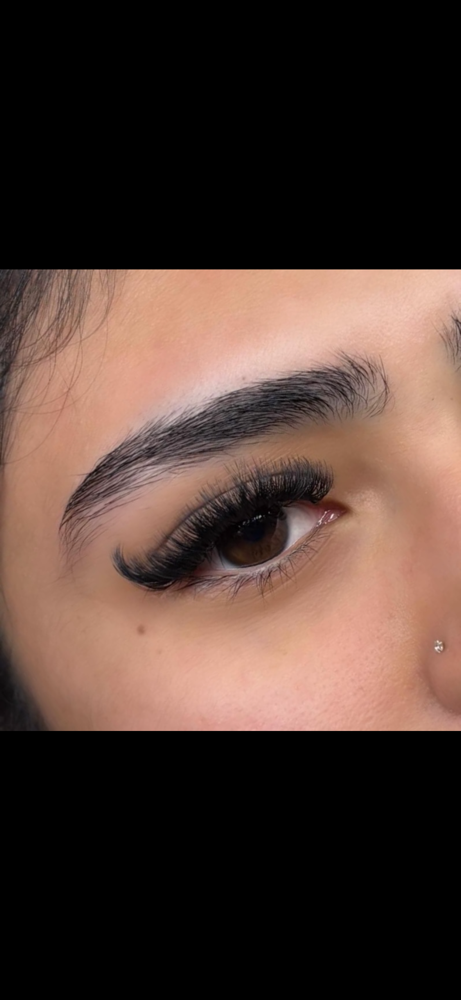 Volume Fill at House of Esthetics LLC in Casa Grande, AZ