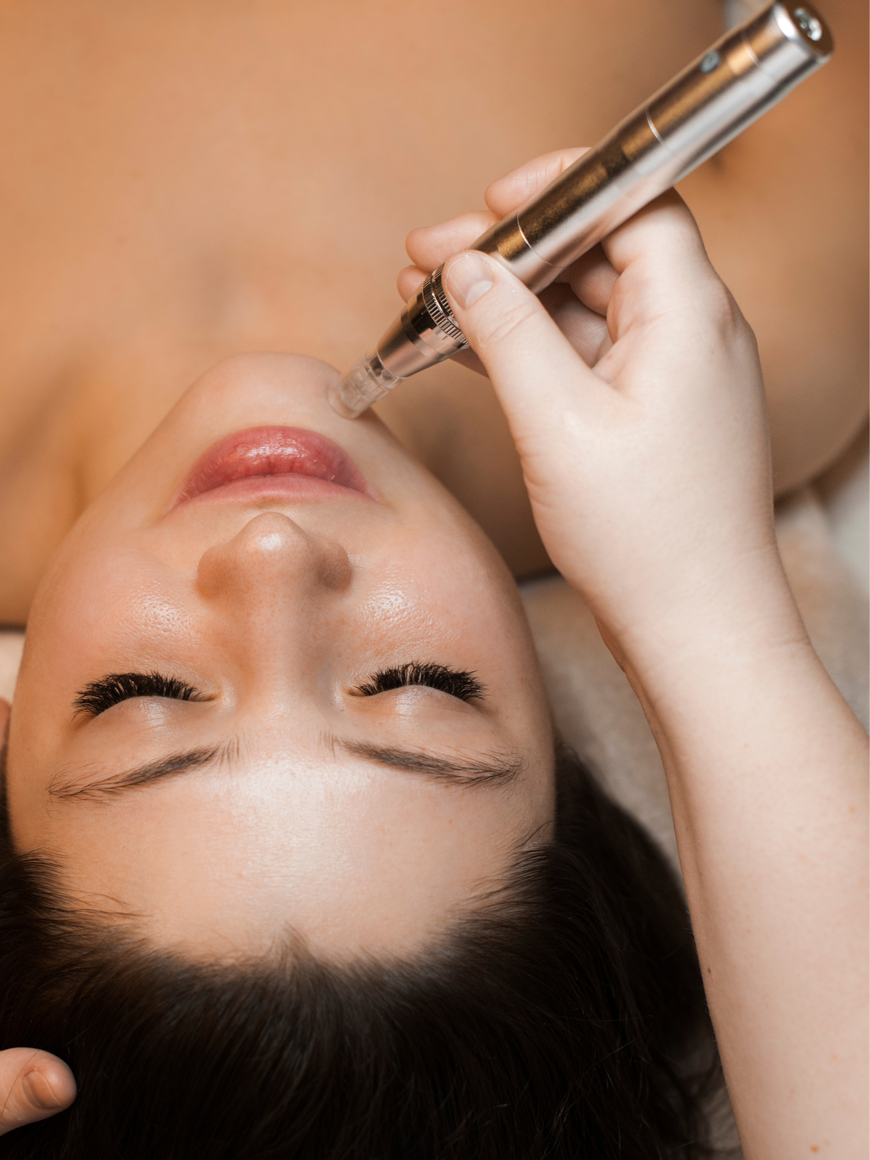 Diamond Microdermabrasion