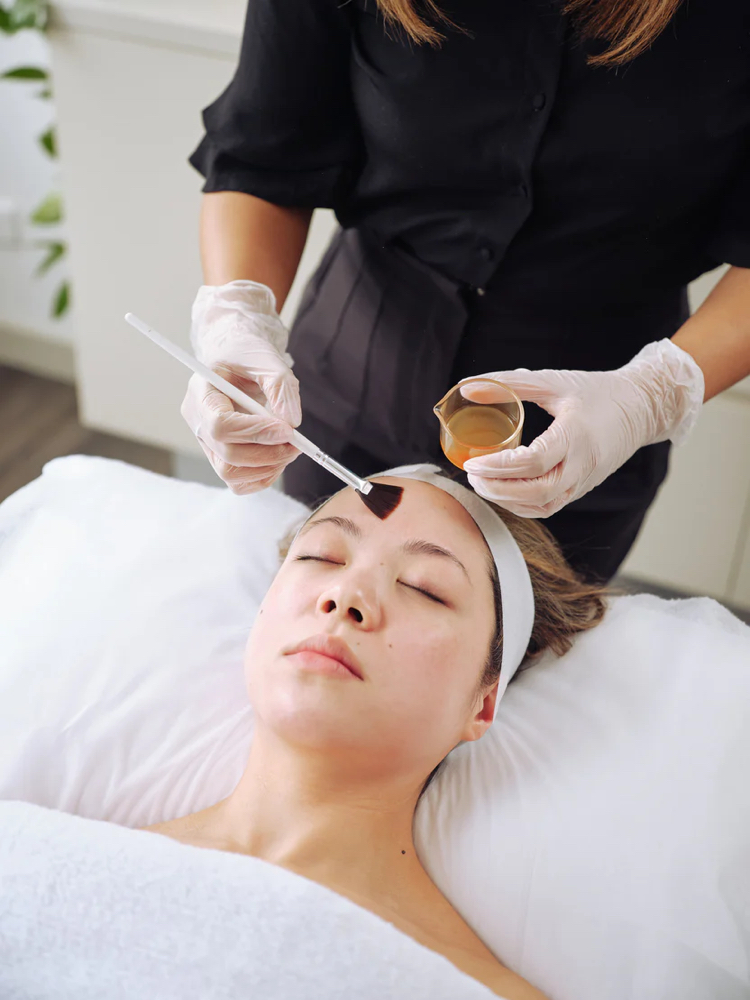 Chemical Peel Facial