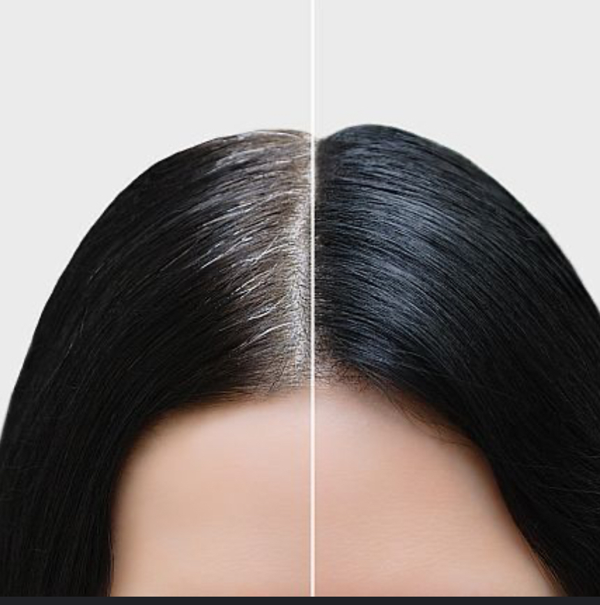 Root Touch-Up