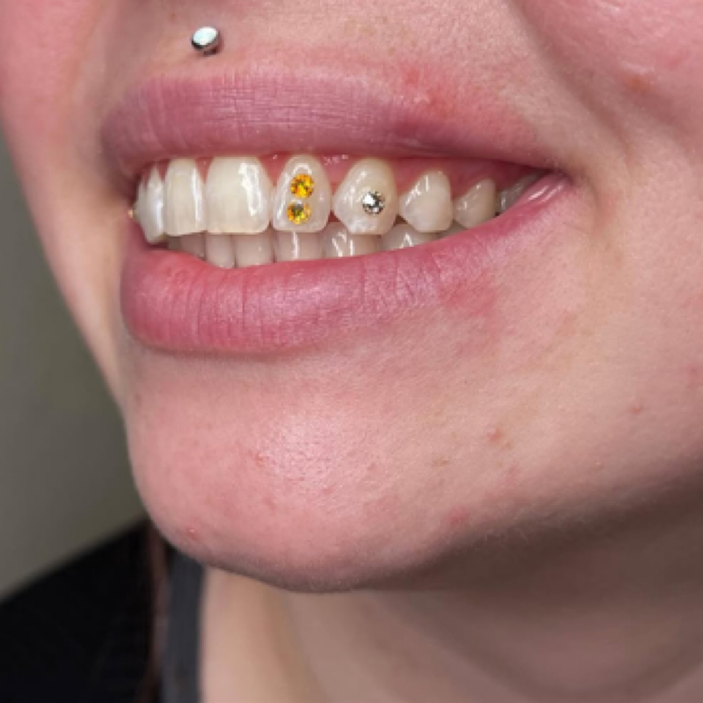 3 Tooth Gemz at Princesaa Piercings x Aesthetics in Chandler, AZ