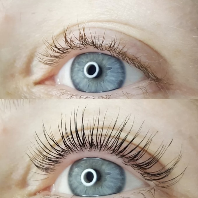 Eyelash Lift