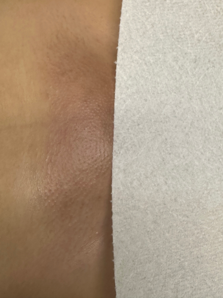 Brazilian at Purity Esthetics in Salinas, CA