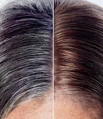 Root Touchup
