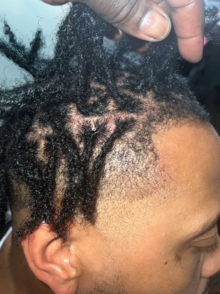 Inter-locs