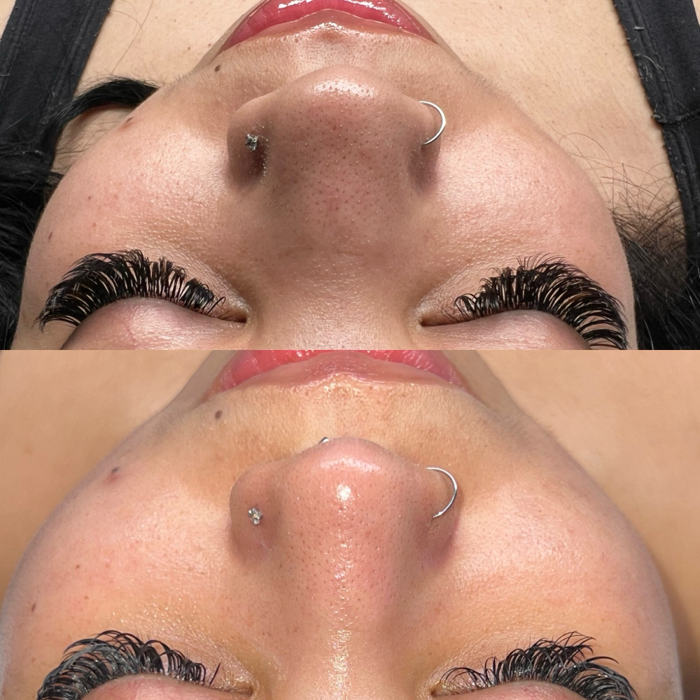 Custom Facial