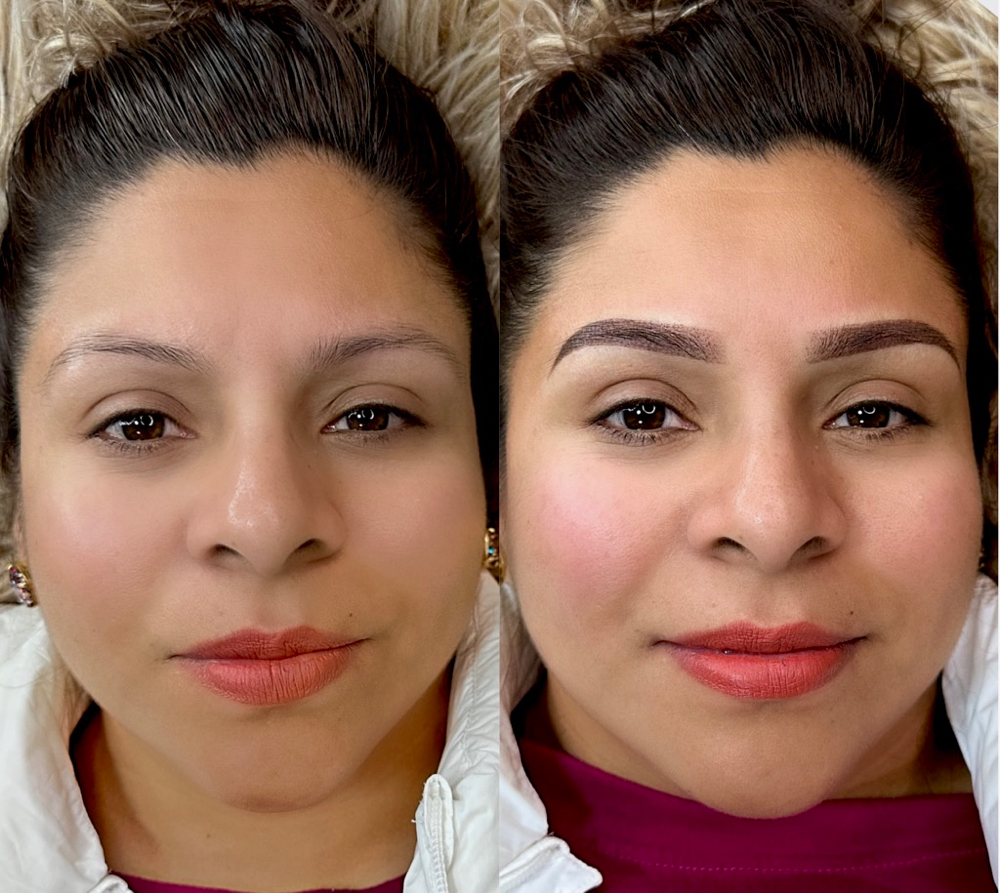 6-8 Week Follow Up