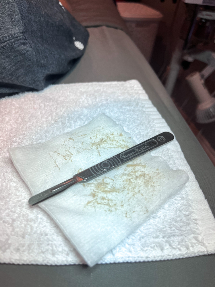 Dermaplane Add On/Express