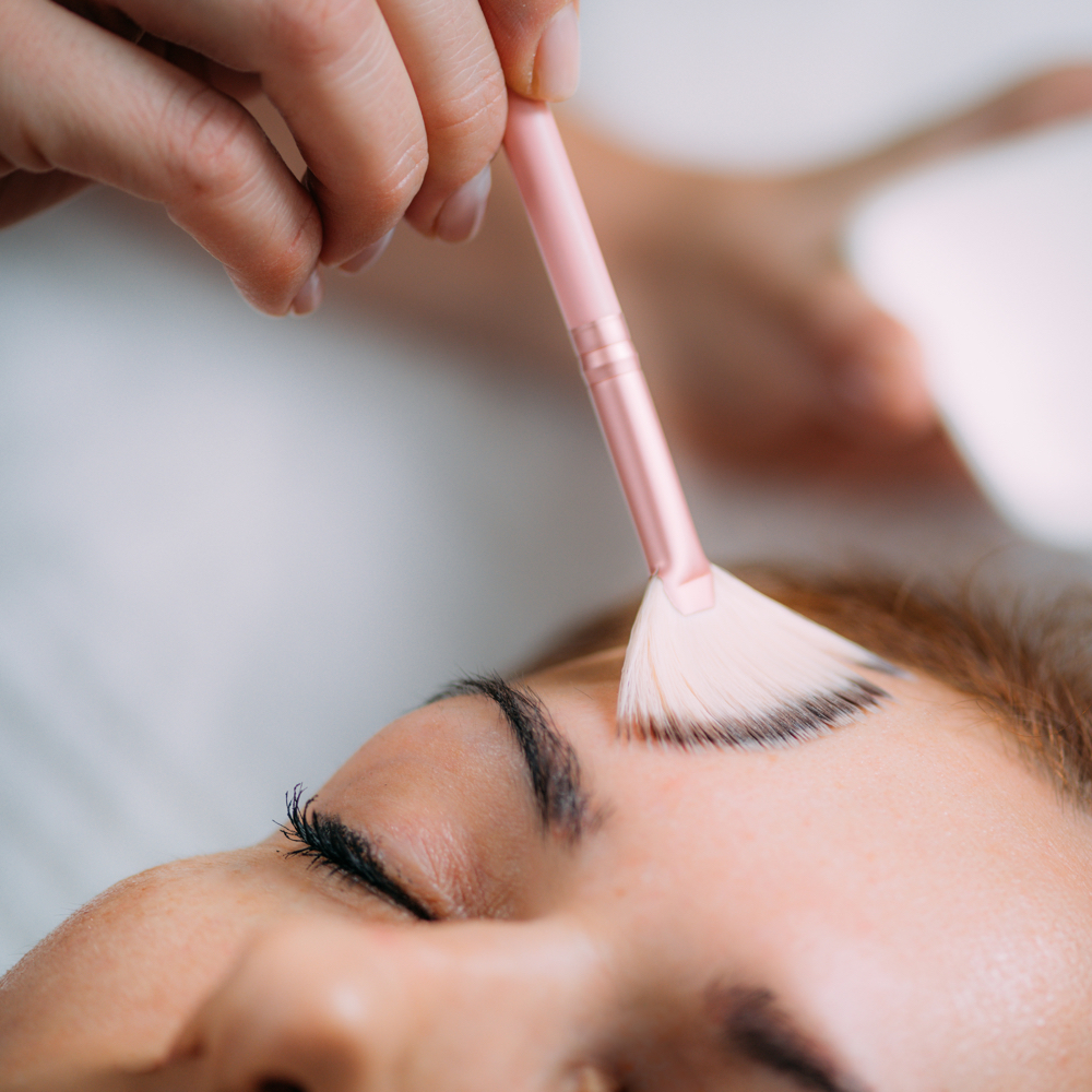 Photo-Aging Peel at Estética by Martha in Feasterville, PA