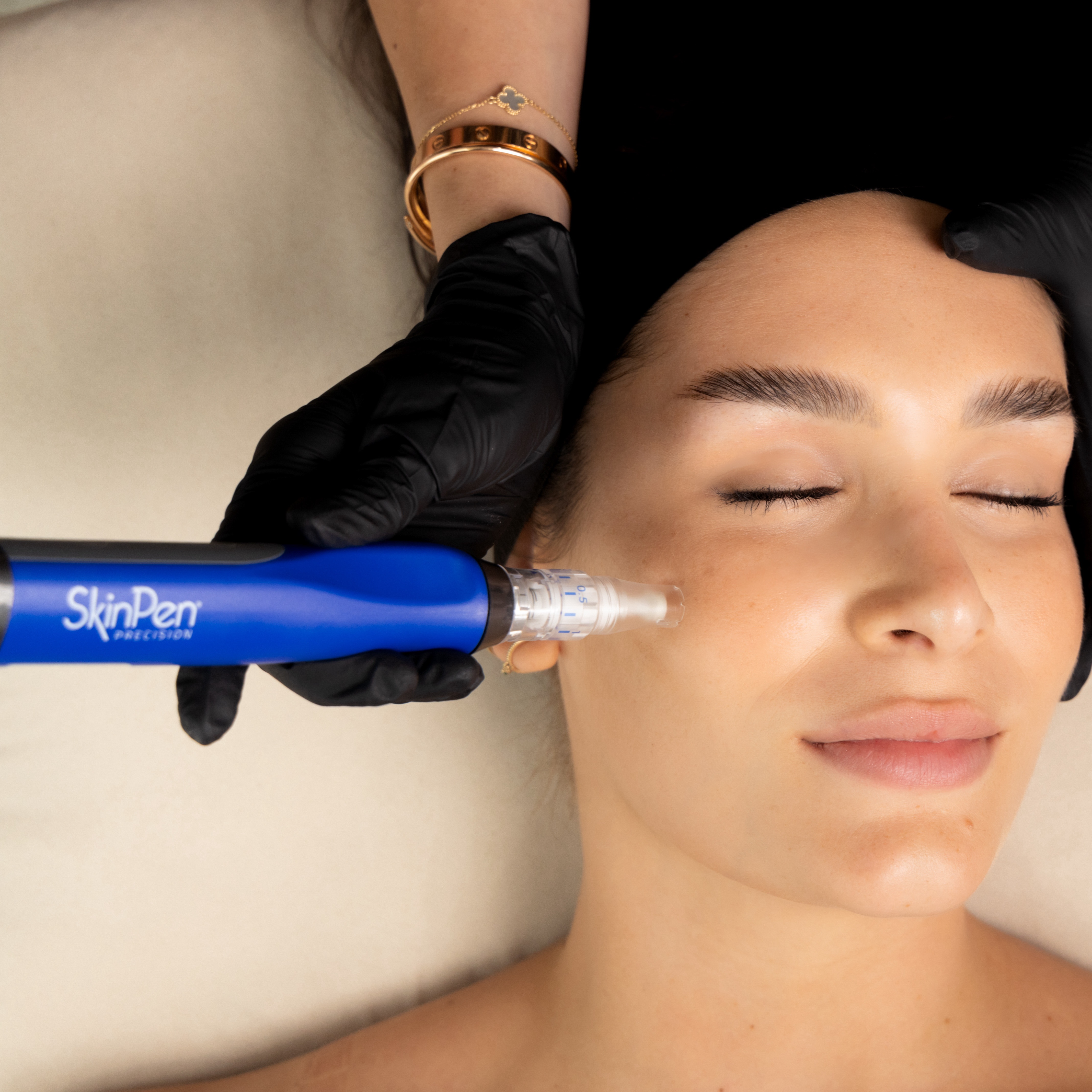 Skin Pen Microneedling at JENNVIE Med Spa in Westport, CT