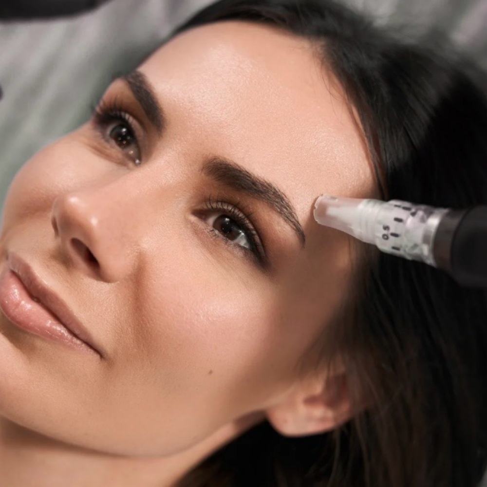 Microneedling w/Stems Cells at Snatched Waxing & Aesthetics in Denver, CO