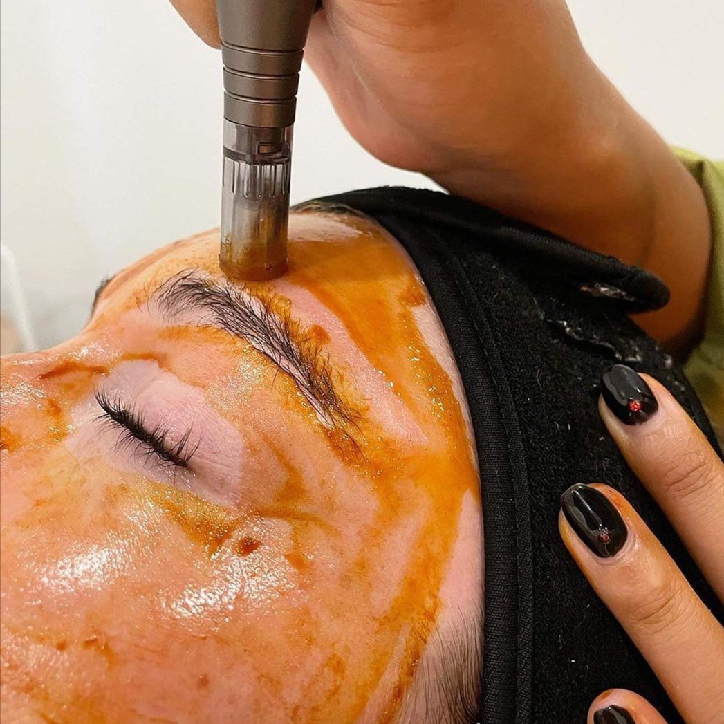 Trifusion Facial at SoLuna Aesthetics in Scottsdale, AZ
