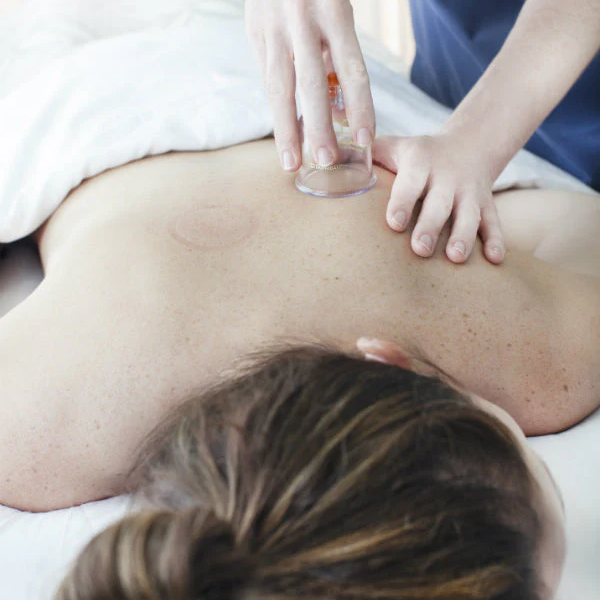 Cupping therapy - 60 minutes