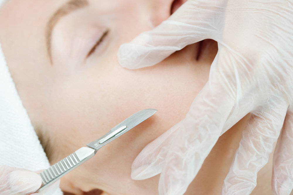 Dermaplaing Facial