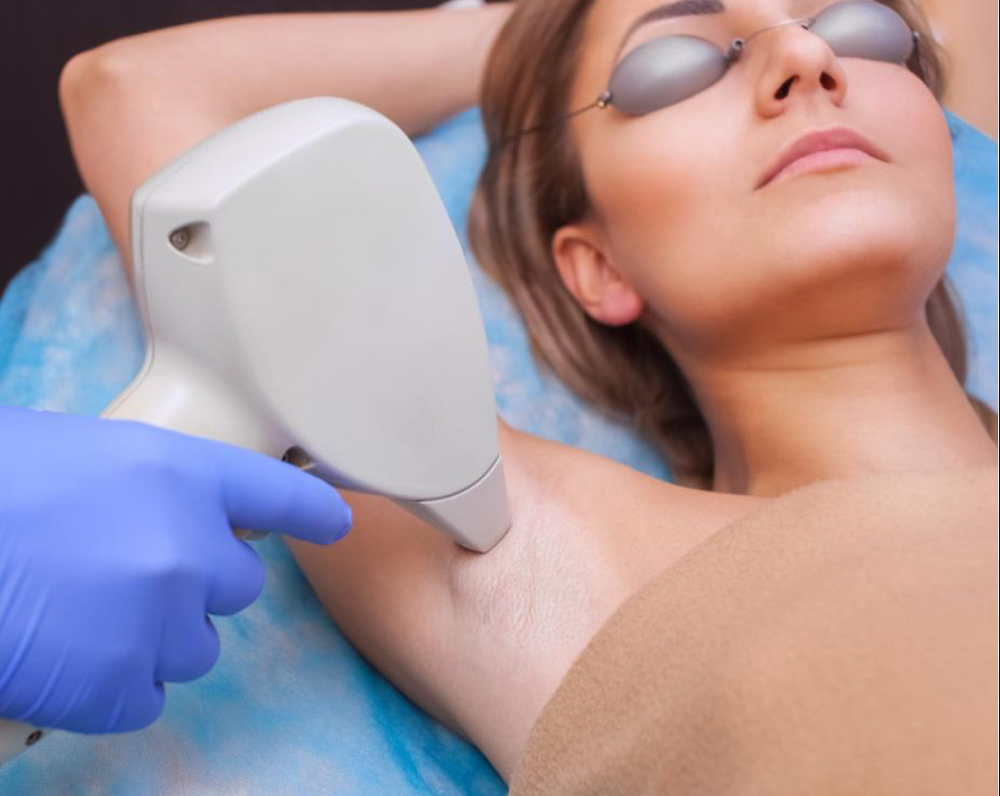 Laser Hair Removal