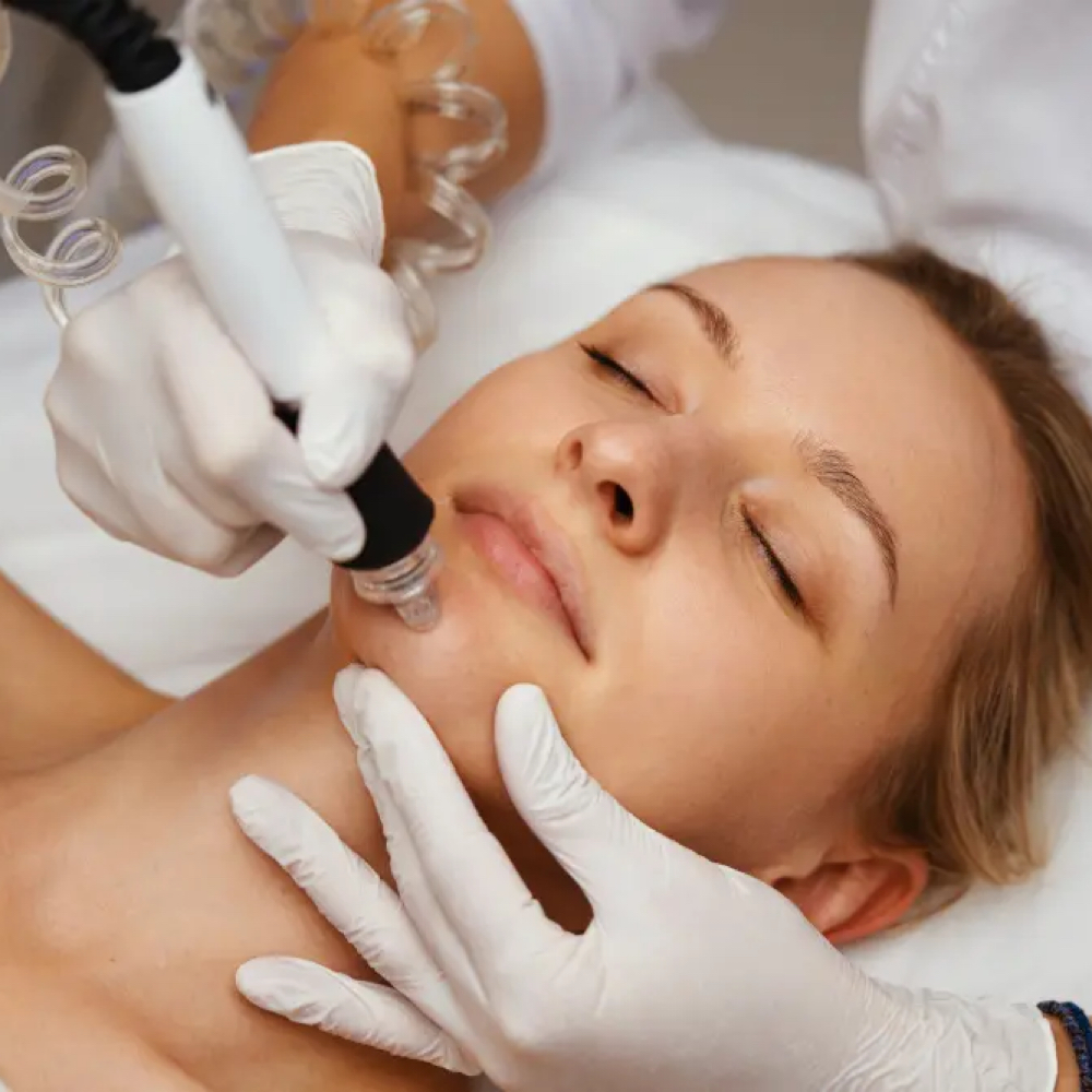 Microneedling Add-on w/ PRX Service at Poppy & Aster Beauty Bar in Columbia Falls, MT