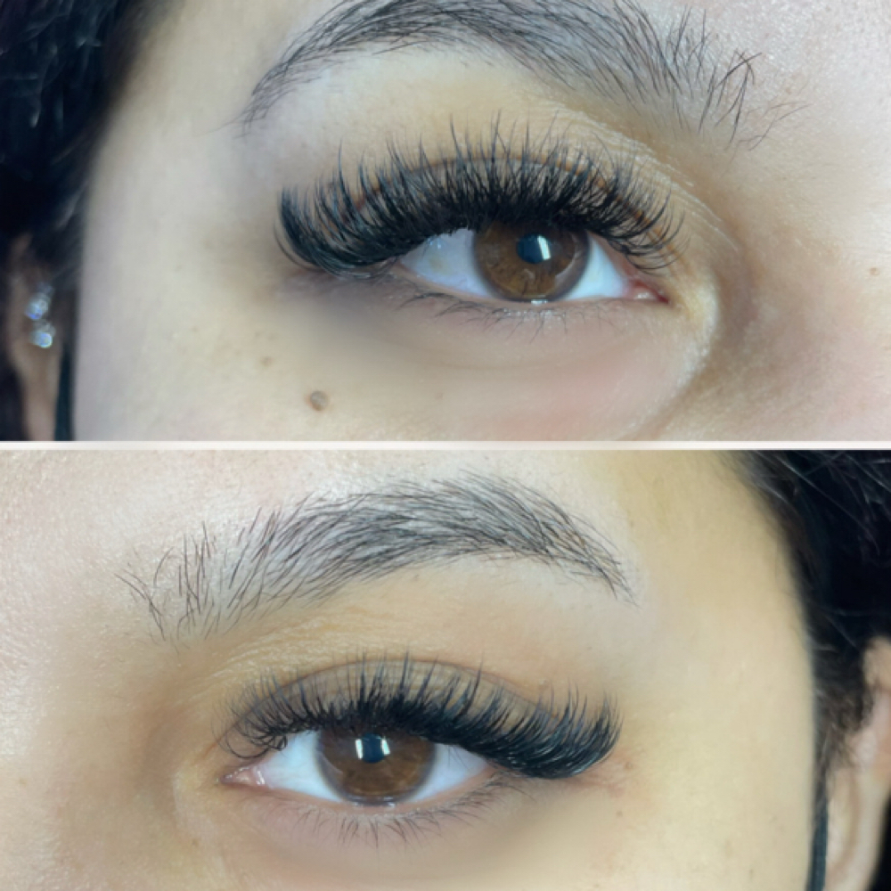 Volume Refill at Soluna Aesthetics + Academy in Philadelphia, PA