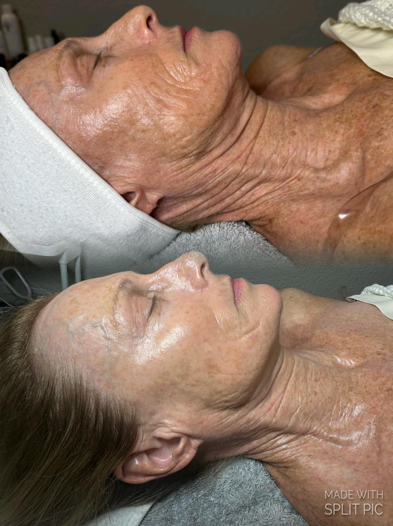 ANTI-AGING FACIAL