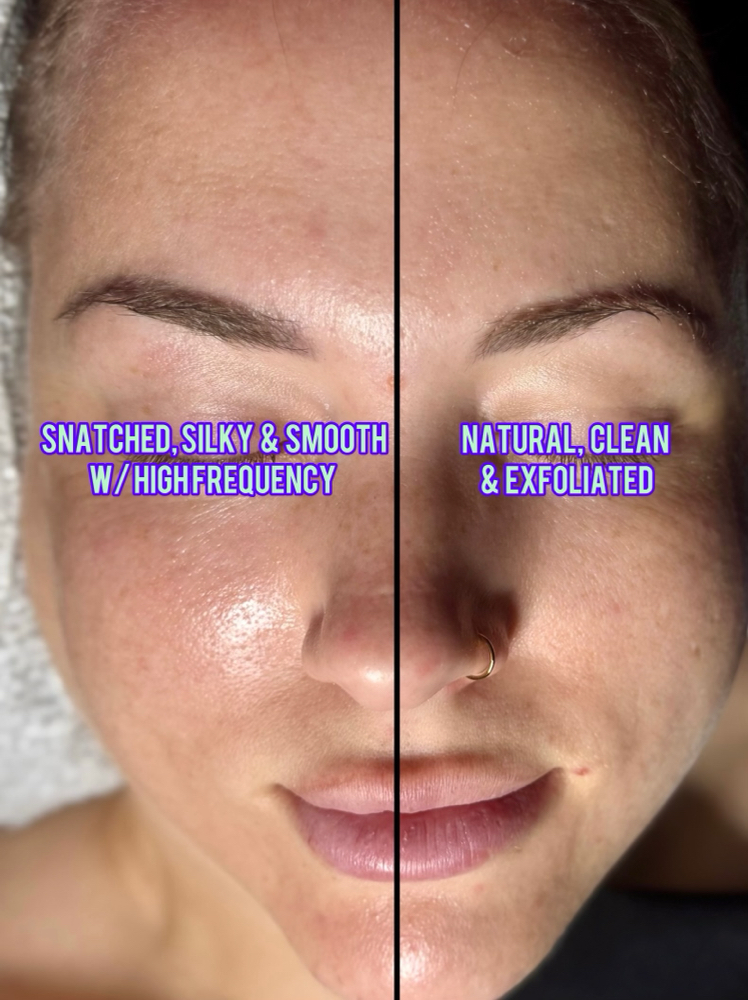 High Frequency & Custom Skin Serum