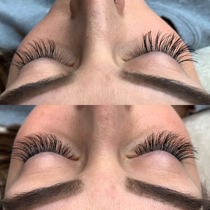 Full Volume Extensions (Fill)