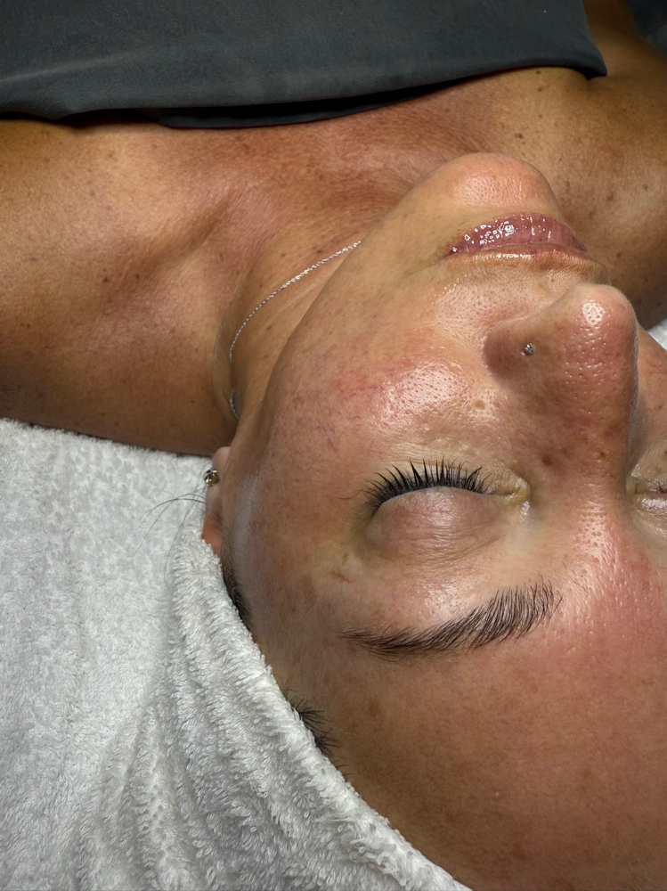 Dermaplane Facial at Gloss and Glow with Tone in Gas City, IN