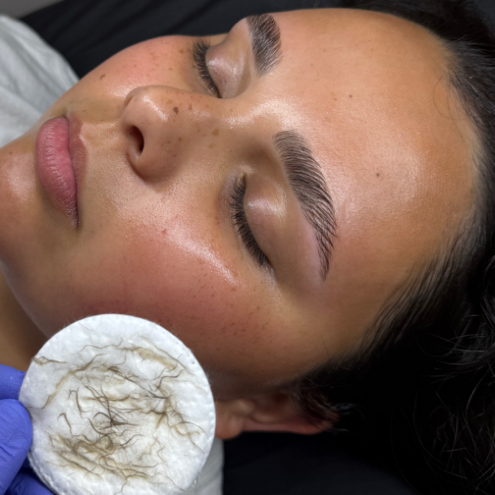 Dermaplane Treatment at Angel Girl Artistry in Albany, NY