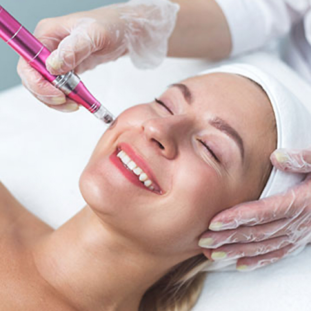 Nano-Needling Facial at Restored Glow Aesthetics in Whitehouse Station, NJ