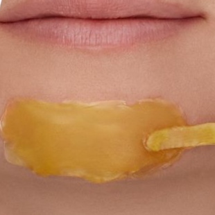 Chin at Rahil Beauty Esthetics in Canfield, OH