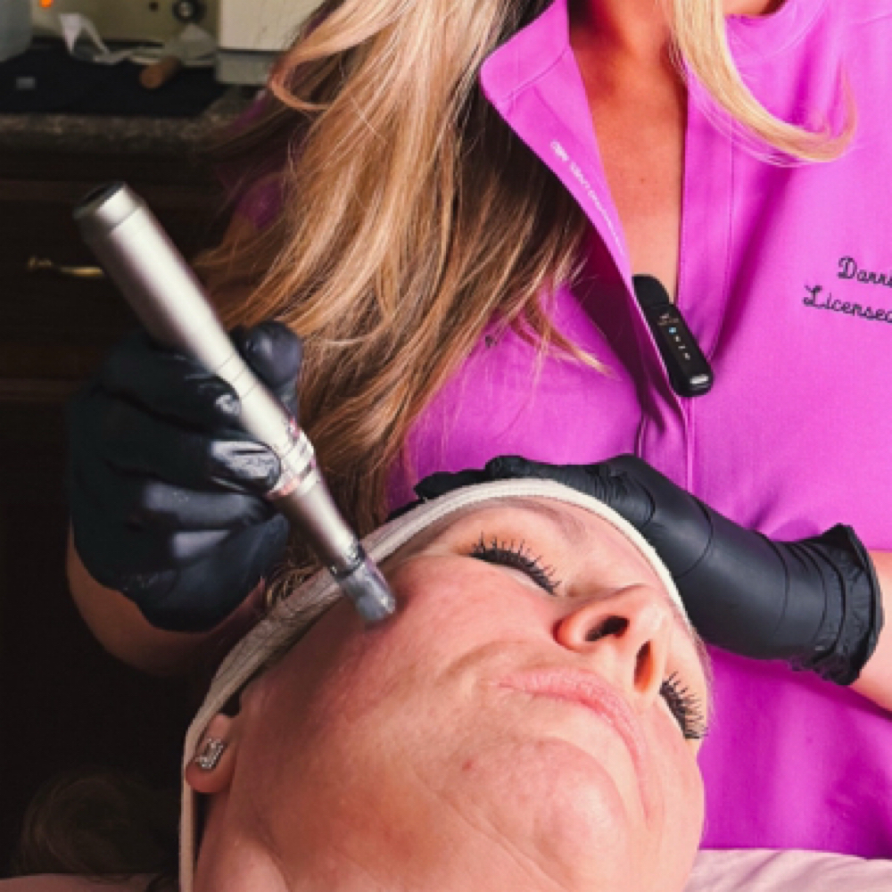 Microneedling Package (6) at Healthy Skin Day Spa in Abilene, TX