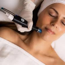 Microdermabrasion