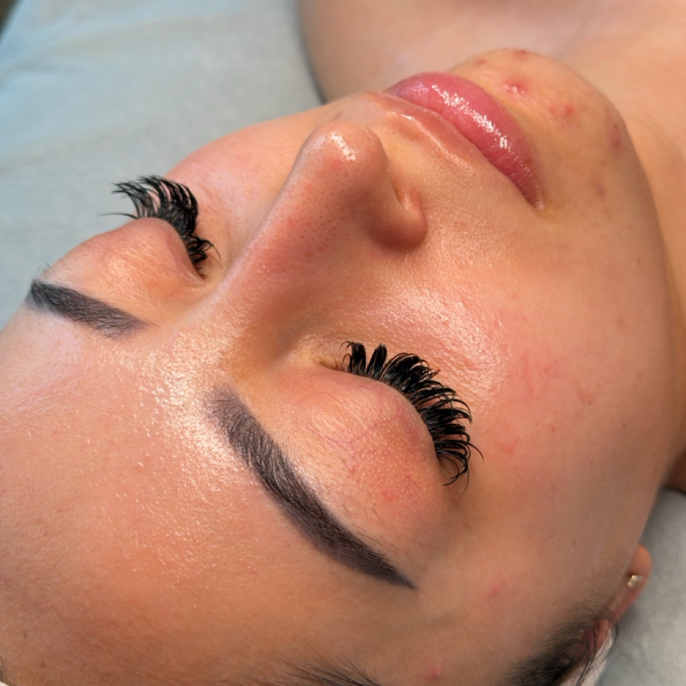 The Blume Facial at blumesthetics in Riverside, CA