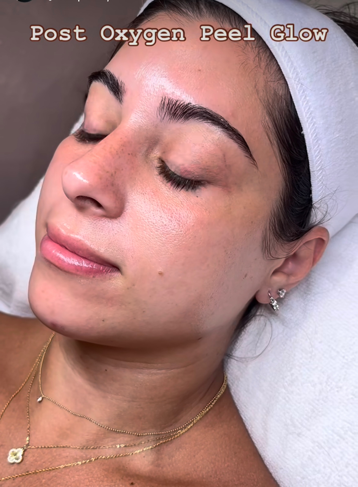 Oxygen Regenerative Peel