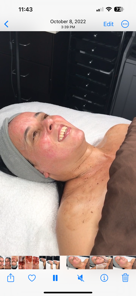 Sensitive Skin Facial