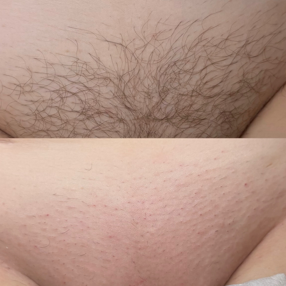 Brazilian Wax at Exquisite Studios in Lady Lake, FL