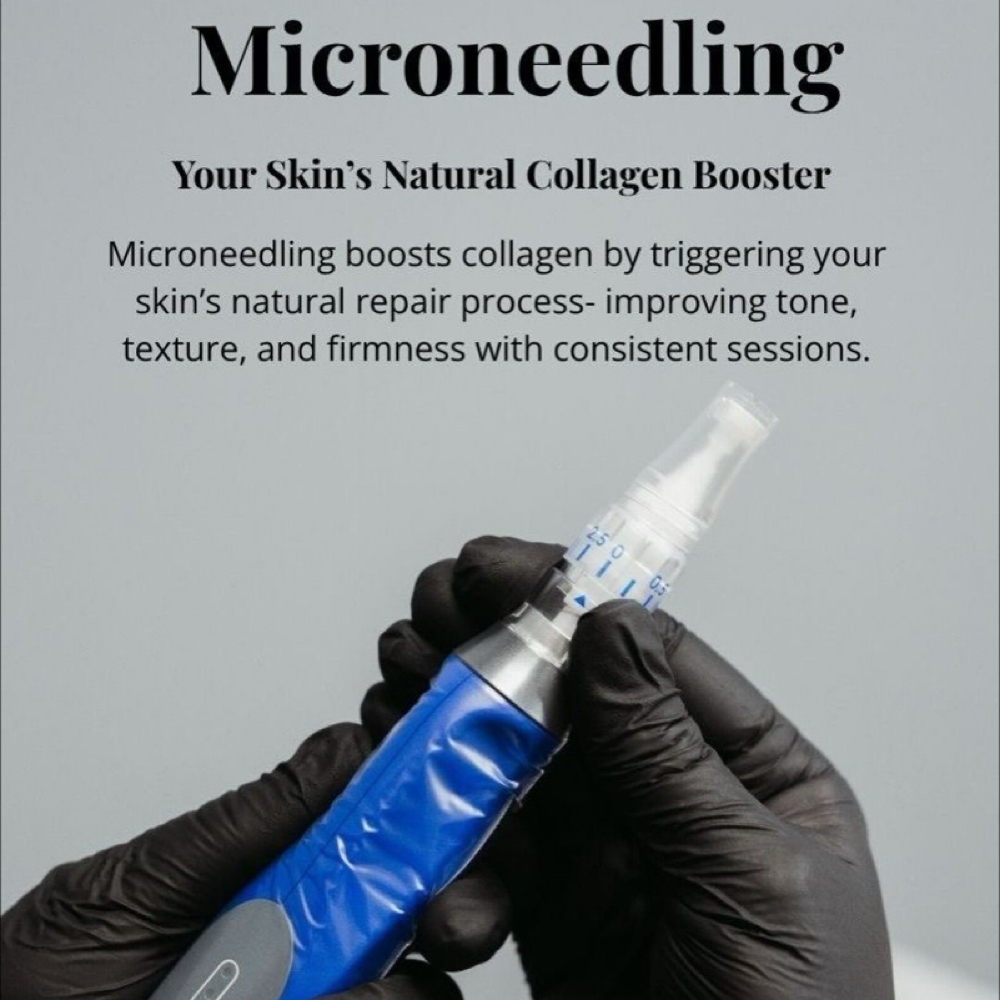Microneedling Facial at Skin And Beauty By Elle in Livonia, MI