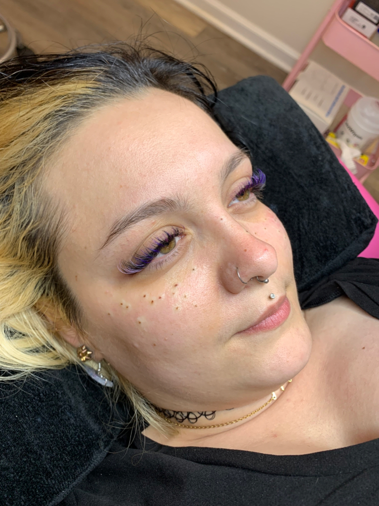 Freckles