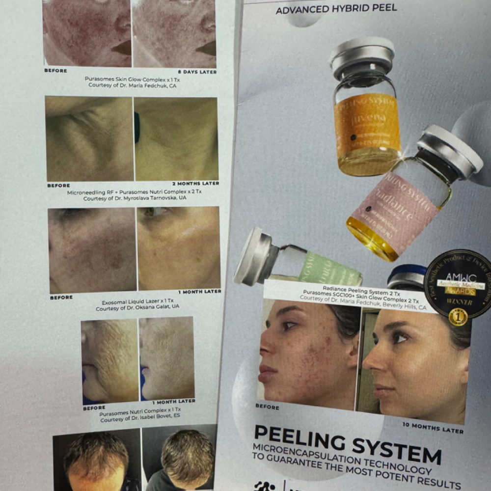 Peeling System(all season peeling) at Maryna Skin Studio in Chicago, IL