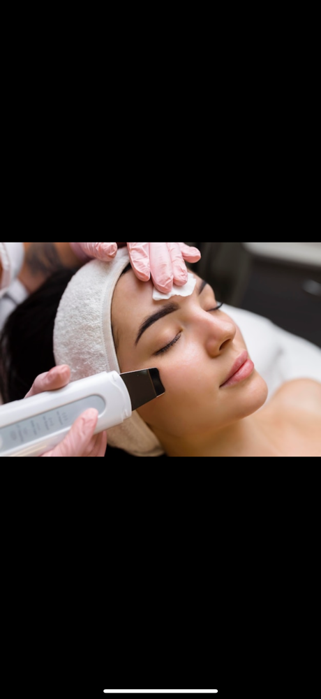 The UltraSonic Skin Treatment