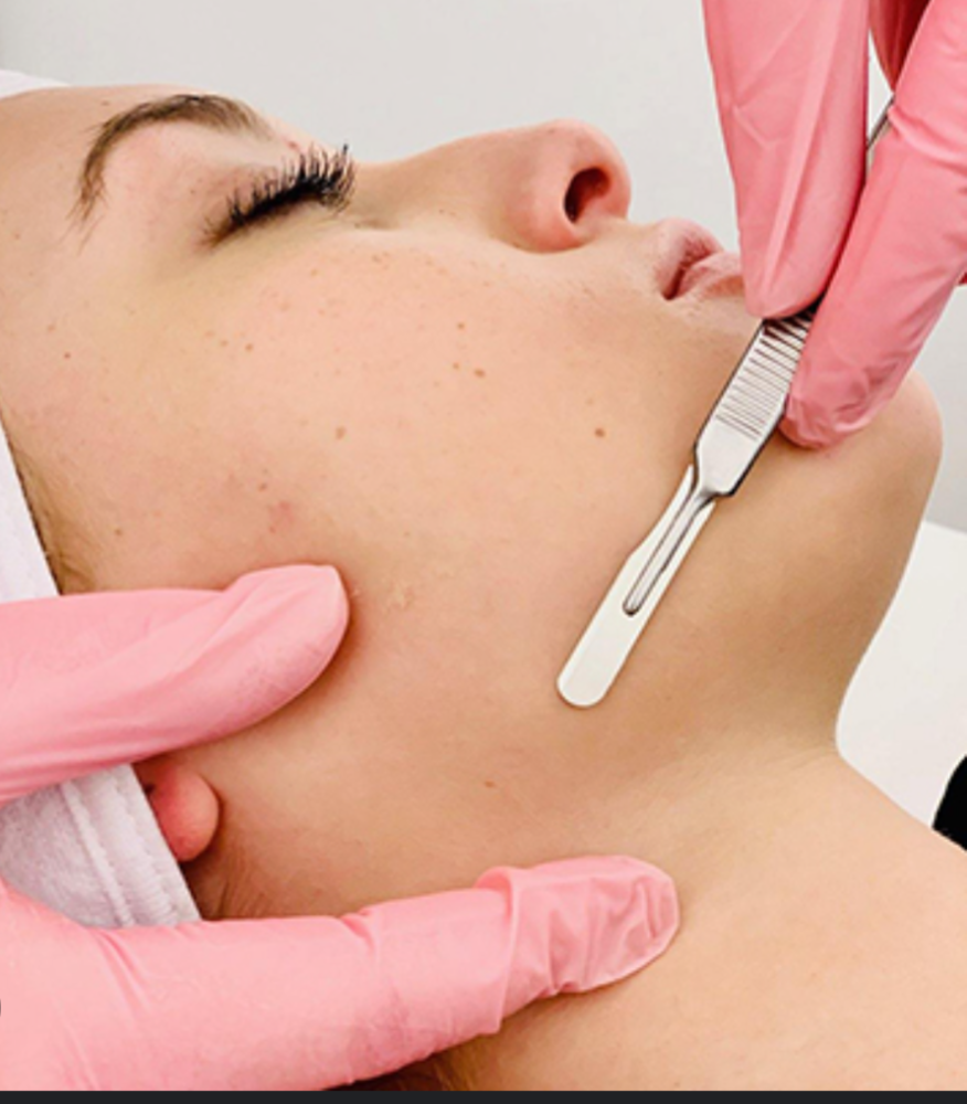 Fuzz Off Darling Dermaplaning