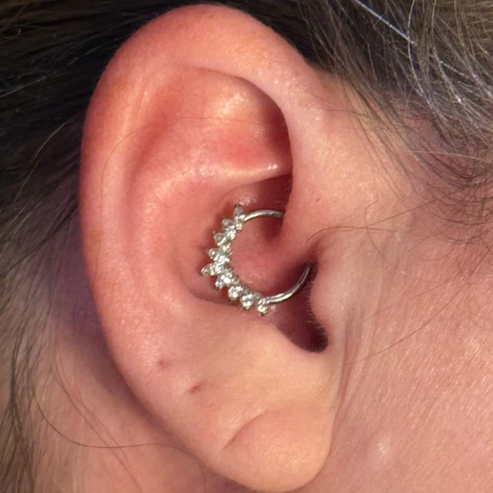 Daith at The Skin Academy Indy in Indianapolis, IN