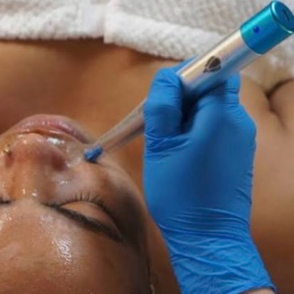 Nano Infusion Facial at JANA LEE Aesthetics in Lake Oswego, OR