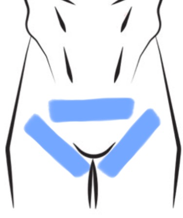 Bikini Line P