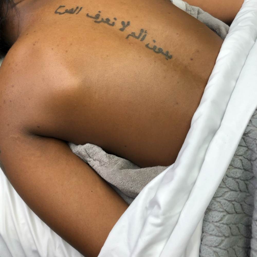 Body Peels at Skin Therapy in Golden valley, MN