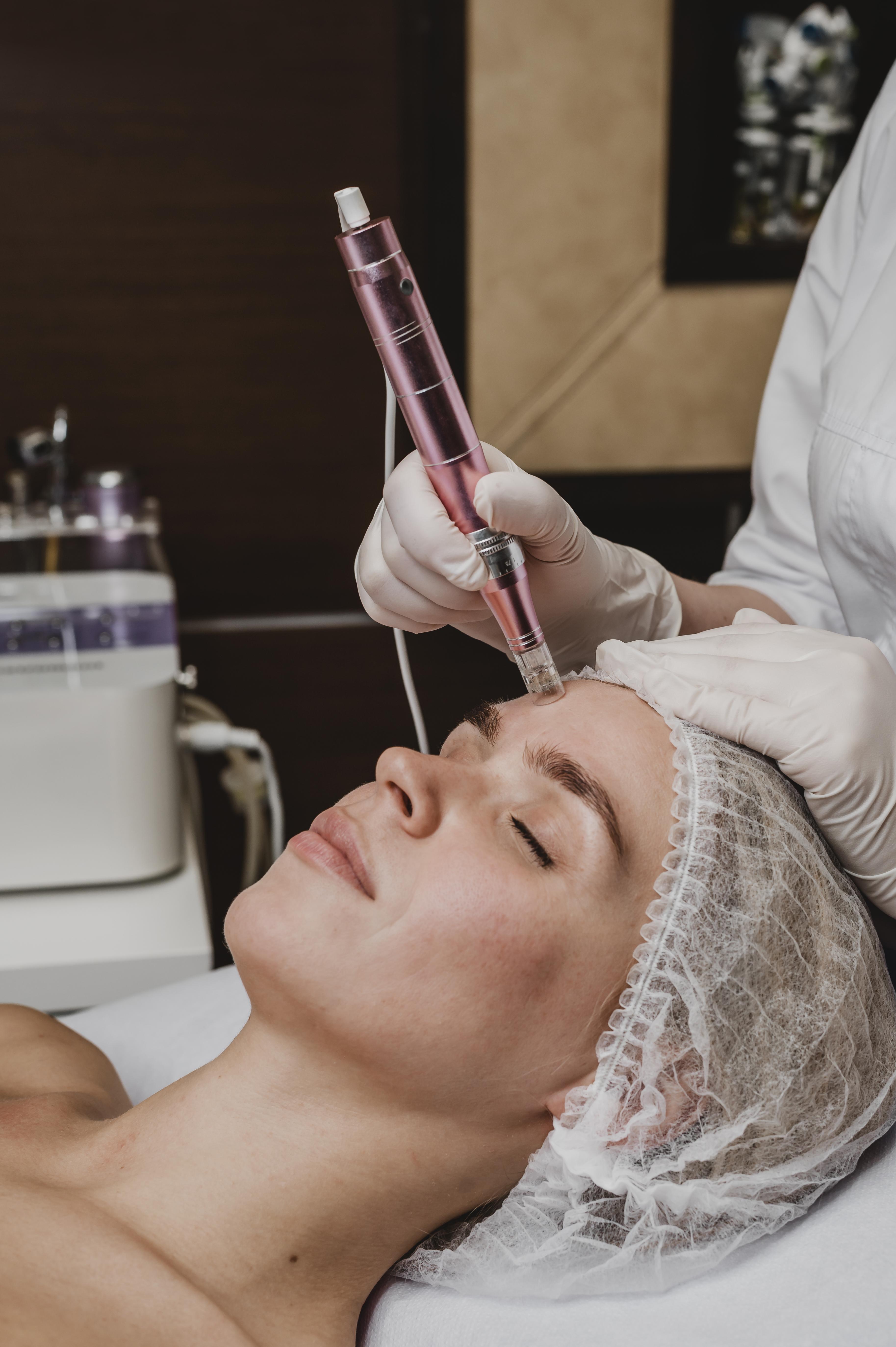Microdermabrasion Treatment
